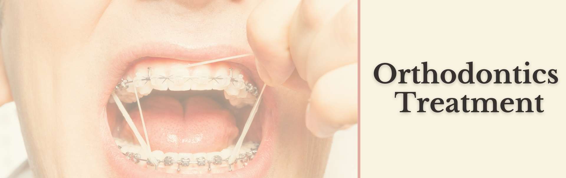 Orthodontics Treatment